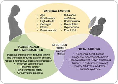 Knowledge Gaps and Emerging Research Areas in Intrauterine Growth Restriction-Associated Brain Injury